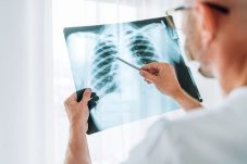 Sebanyak 100 warga di Kampung Susun Akuarium mengikuti Pemeriksaan Kesehatan Gratis di Hari Tuberkulosis Sedunia